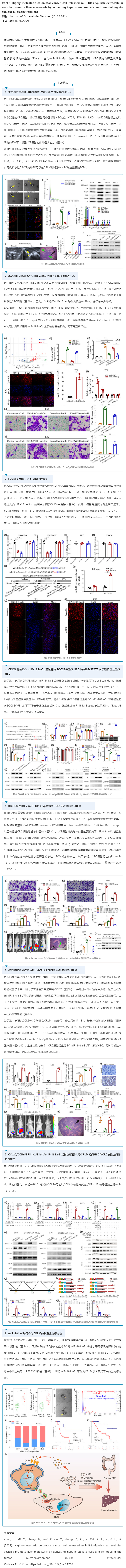 文獻(xiàn)解讀_miRNA 芯片技術(shù)揭示細(xì)胞外囊泡 miRNA 促進(jìn)結(jié)直腸癌肝轉(zhuǎn)移新機(jī)制