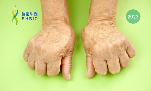 高分文獻一作分享會 | 時空組學(xué)技術(shù)助力發(fā)現(xiàn)類風(fēng)濕關(guān)節(jié)炎疾病治療新靶點